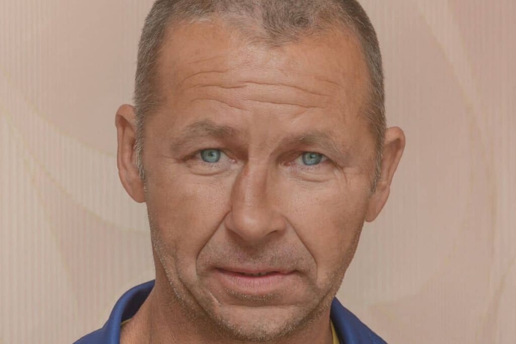Middle-aged man with symmetrical nose and clear skin, illustrating results of surgical nose straightening rhinoplasty