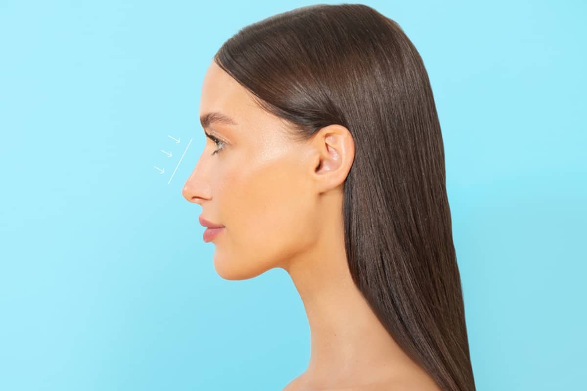 A profile view of a woman with long dark hair against a blue background, featuring white surgical arrows pointing toward the bridge of her nose.