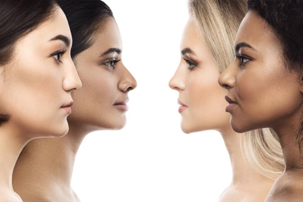 Four women of different ethnicities—including Asian, Black, and Caucasian—shown in profile to display a diverse range of natural nasal structures and shapes.